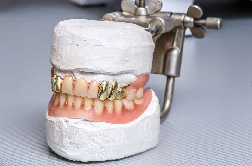 gold in dentistry